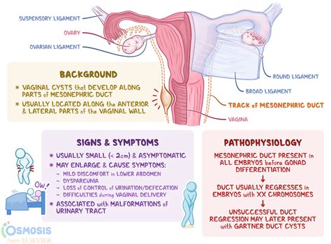 glândulas de bartholin e de skene|Bartholins gland